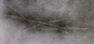 Transmission EM from diseased Albuca extract